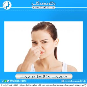 بدبویی بینی بعد از عمل جراحی بینی