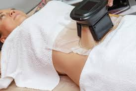 همه چیز درباره دستگاه لاغری موضعی کرایولیپولیز