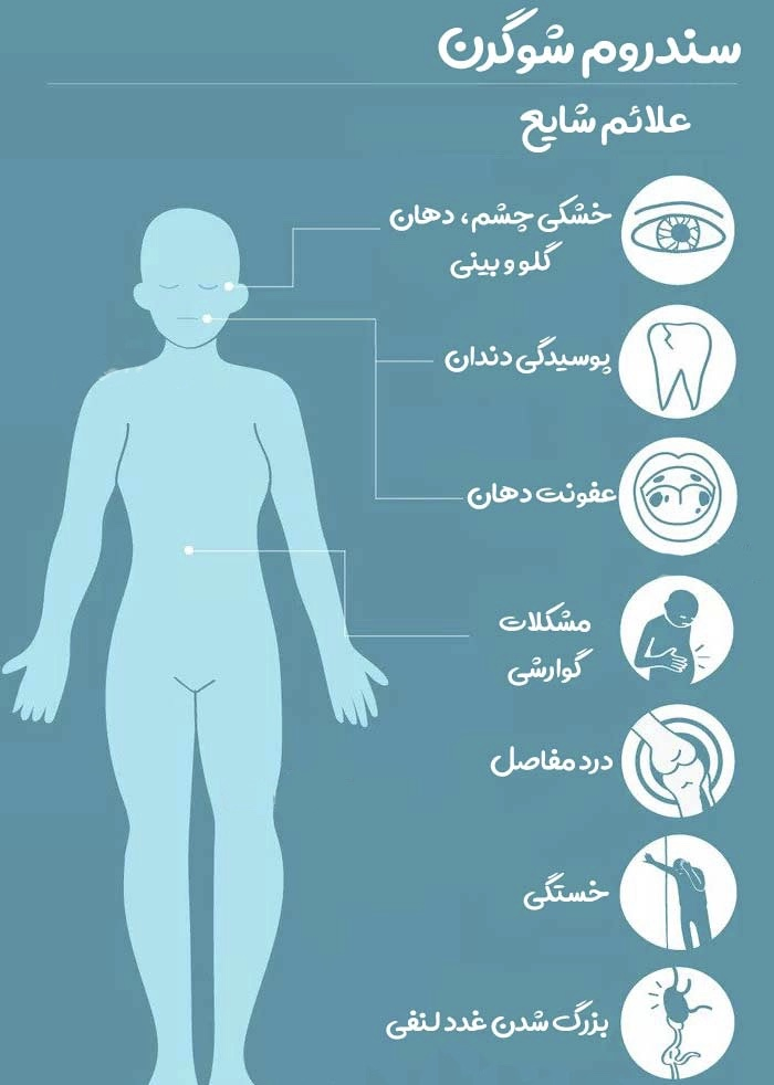 نکات تغذیه ای در مبتلایان به سندروم «شوگرن»