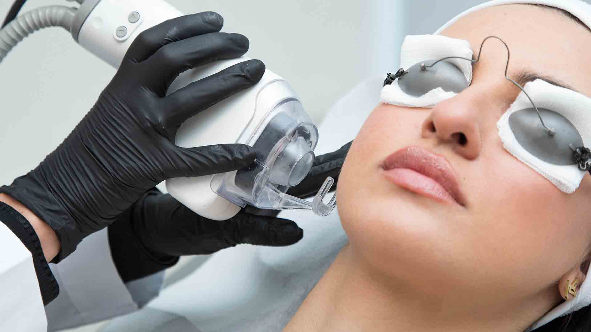 مراقبت های  لیزر CO2  فرکشنال
