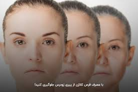 کلاژن و مزایای آن