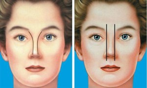 سن مناسب برای جراحی زیبایی بینی