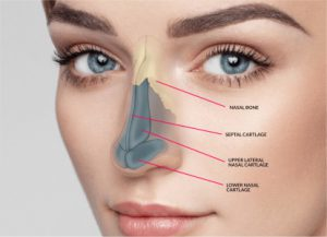 چالش های جراحی زیبایی بینی