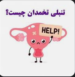 تنبلی تخمدان چیست؟ رژیم غذایی در تنبلی تخمدان نقشی دارد؟