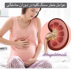 سنگ کلیه در دوران بارداری