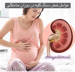 سنگ کلیه در دوران بارداری