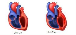 آیا عضله قلب عفونت می کند