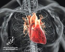 همه چیز درباره عمل جراحی بایپس قلب