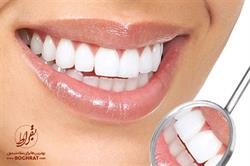 سلامت دهان و دندان دریچه ای بسوی سلامت کلی شما است!