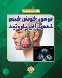 💉 تومور خوش خیم  غده بــزاقی پاروتید