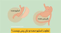 انواع جراحی چاقی و یک نمونه رژیم بعد از اسلیو