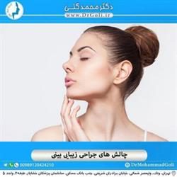 چالش های جراحی زیبایی بینی
