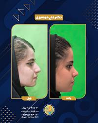 مدیریت ترس با مشاوره حضوری