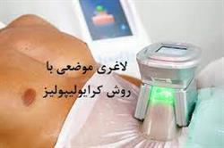 بدون پیکرتراشی لاغر شو