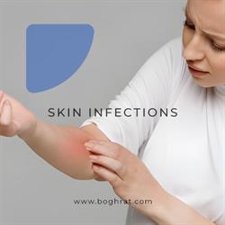 شپش ، گال یا بیماری های پوستی چطور منتقل می شن؟