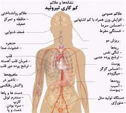 کم کاری غده تیروئید