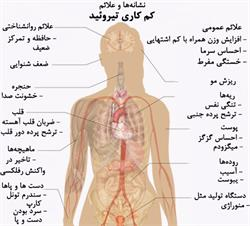 کم کاری غده تیروئید