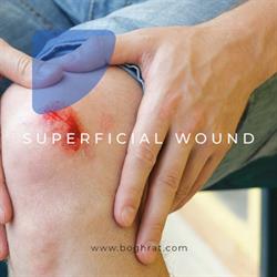 برای زخم سطحی یا سوختگی خفیف، چه کنم؟