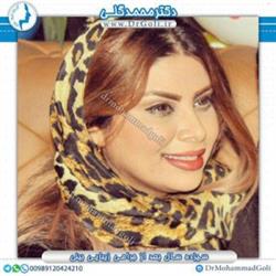 جراحی بینی فانتزی