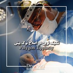 جراحی زیبایی Polygon Tipplasty
