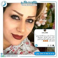 انتخاب جراح بینی
