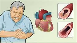 آنژین یا درد قفسه سینه