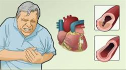 آنژین یا درد قفسه سینه