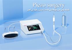 جراحی زیبایی بینی به روش پیِزو (Piezo)