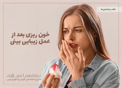 خون ریزی بعد از عمل زیبایی بینی