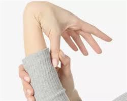 سندرم مارفان چیست؟