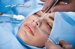 دوره نقاهت عمل بینی