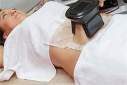 لاغری موضعی با منجمد شدن چربی