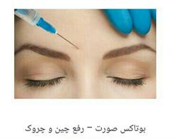 بوتاکس