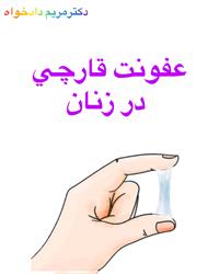 عفونت قارچی زنان