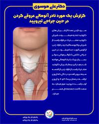 گزارش یک مورد نادر آنومالی عروقی گردن  در حین جراحی تیرویید