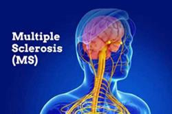 بیماری ام اس  (MS)