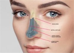 چالش های جراحی زیبایی بینی