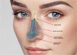 چالش های جراحی زیبایی بینی